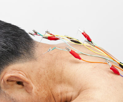 Electro Homeopathy